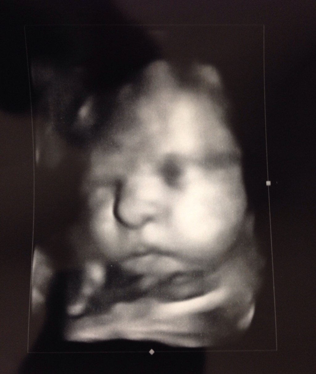 Jun. 27 – The waiting&nbsp;game